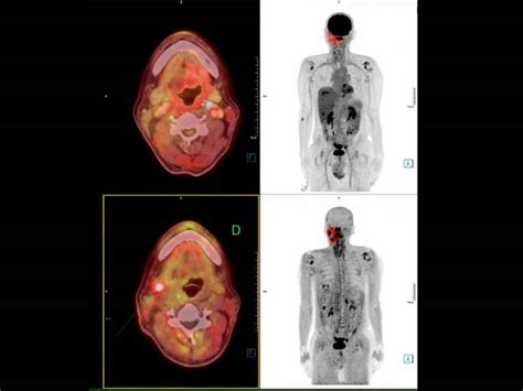 Ilustrace PET/CT skeneru