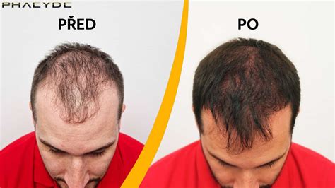 Porovnání struktury TSP před a po změnách v roce 2015