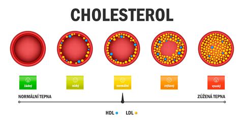 Graf srovnávající snížení LDL cholesterolu dietou a léky