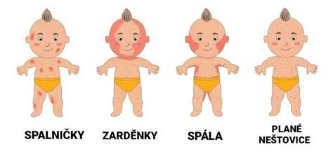 Příznaky neuroblastomu u dětí